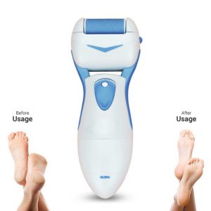 Electric Callus Remover / Pedi Roller (Battery Operated & Washable) - Image 1